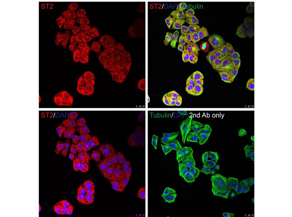 Immunofluorescence of ST2