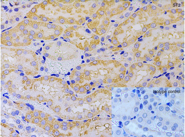 Immunohistochemistry of ST2