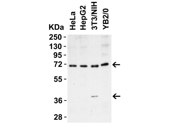 Western Blot of ST2