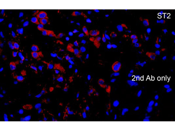 Immunofluorescence of ST2