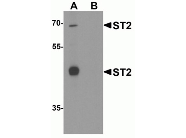 Western Blot of ST2