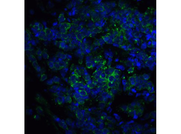 Immunofluorescence of ST2