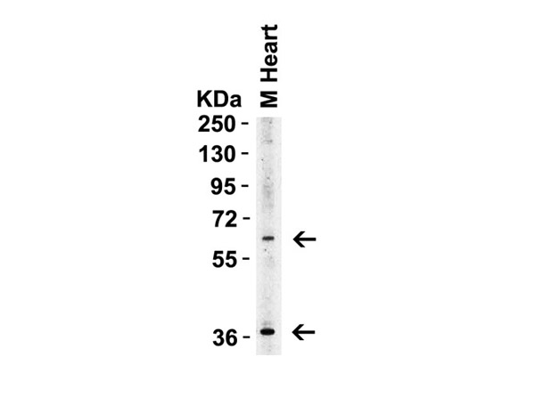 Western Blot of ST2