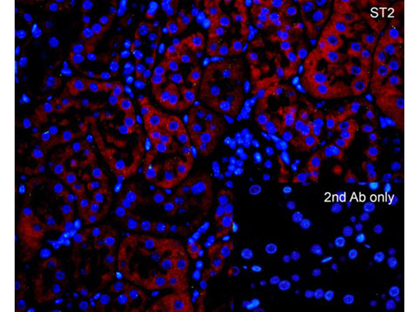 Immunofluorescence of ST2