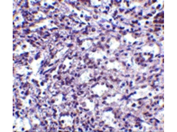 Immunohistochemistry of STIM2