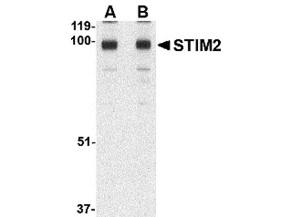 Western blot of STIM2