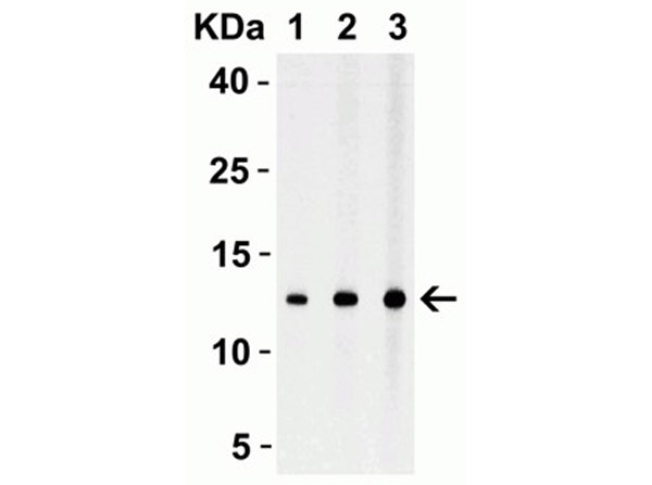 Western Blot with Anti-Strep-tag II