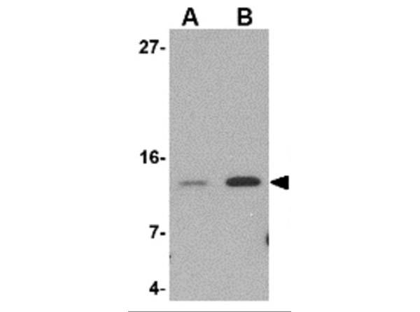 Western Blot with Anti-Strep-tag II