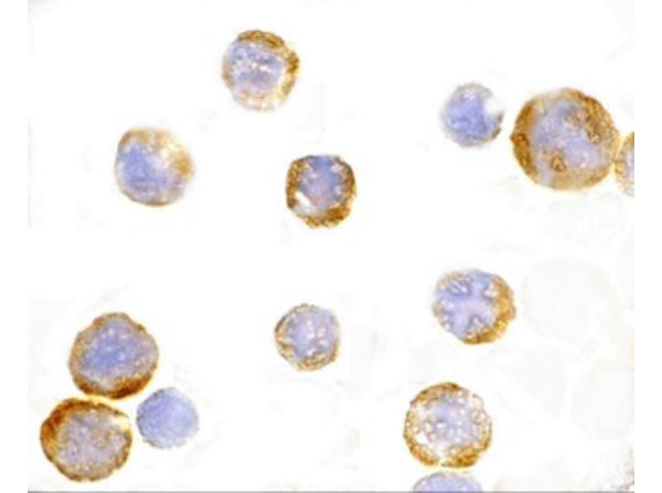 Immunocytochemistry of TLR3