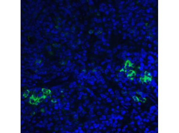 Immunofluorescence of TLR3