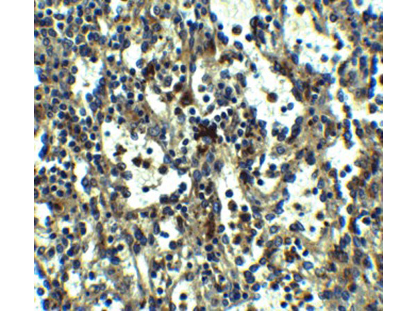 Immunohistochemistry of TLR3