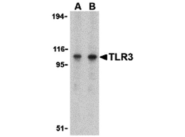 Western blot analysis of TLR3