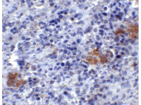 Immunohistochemistry of TLR3