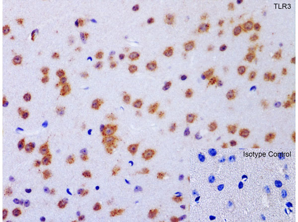 Immunohistochemistry of TLR3