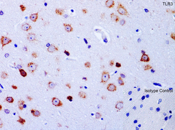 Immunohistochemistry of TLR3