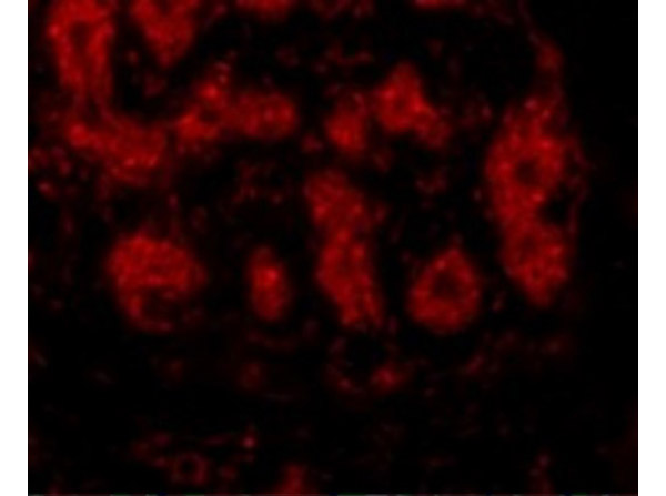 Immunofluorescence of TRIM5 alpha