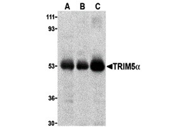 Western blot analysis of TRIM5 alpha