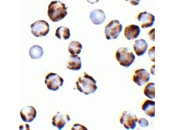 Immunocytochemistry of TRPC6