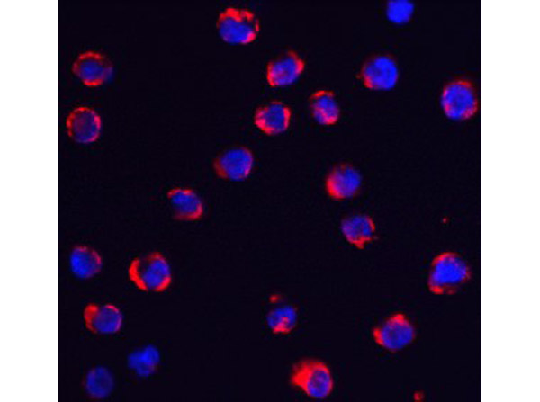 Immunofluorescence of TRPC6