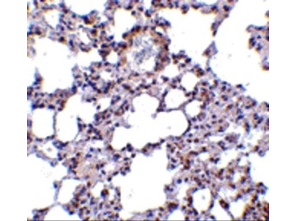 Immunohistochemistry of TRPC6