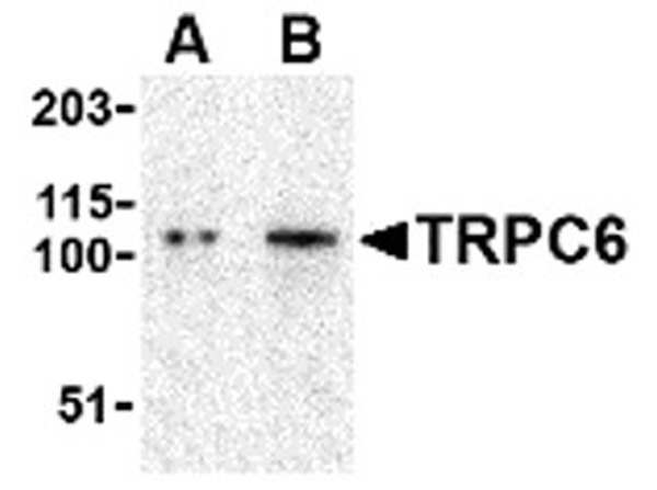 Western blot analysis of TRPC6