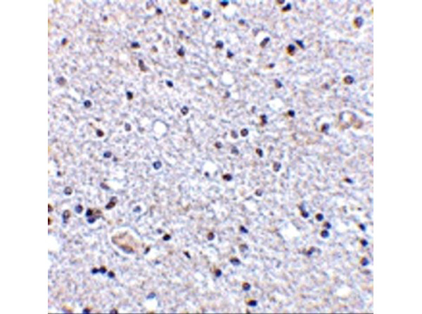 Immunohistochemistry of TSLP