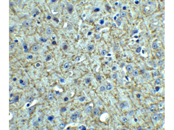 Immunohistochemistry of TSLP