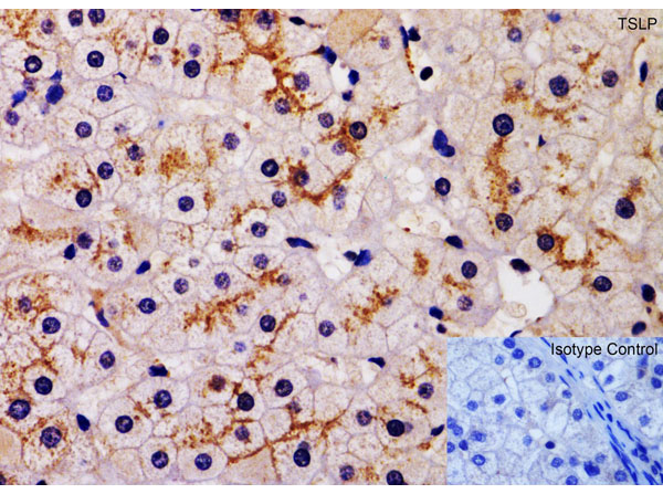 Immunohistochemistry of TSLP