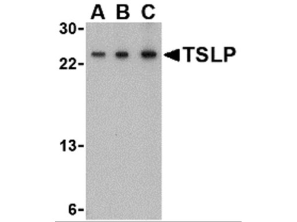 Western Blot of TSLP