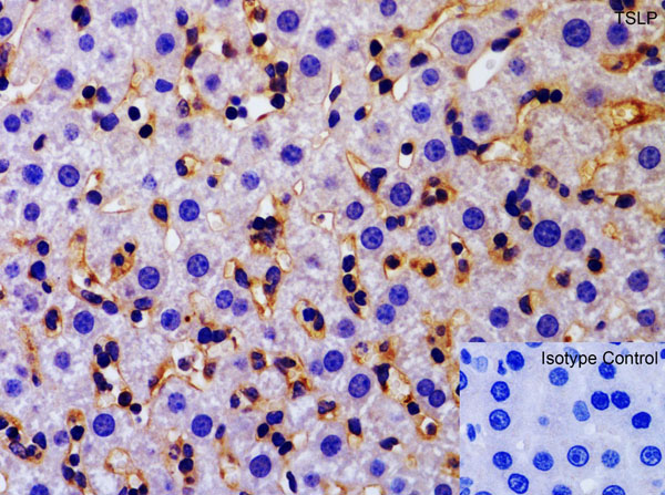 Immunohistochemistry of TSLP