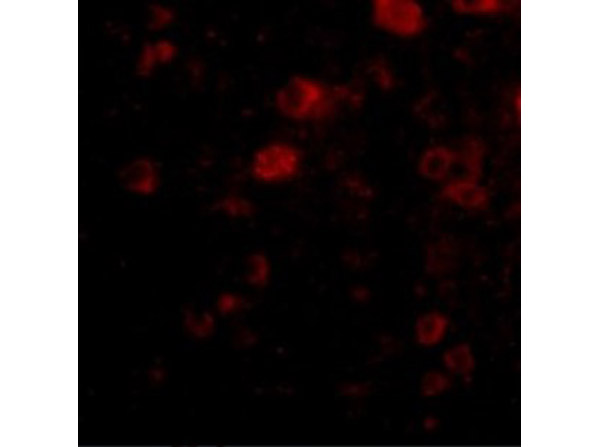 Immunofluorescence of VGF