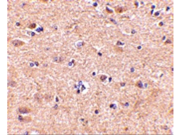 Immunohistochemistry of VGF