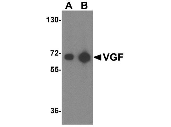 Western blot of VGF