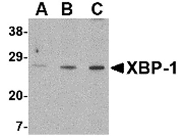 Western blot analysis of XBP-1