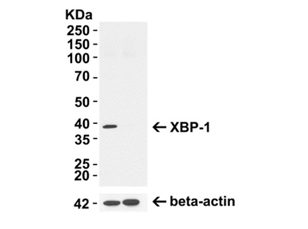 Western Blot of XBP-1