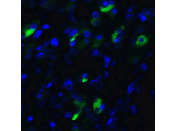 Immunofluorescence of XBP-1