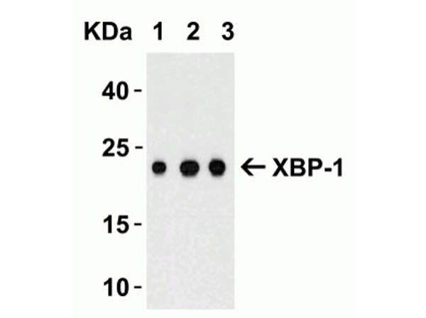 Western Blot of XBP-1