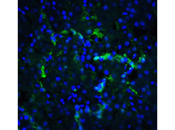 Immunofluorescence of XBP-1