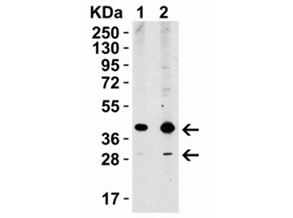 Western Blot of XBP-1