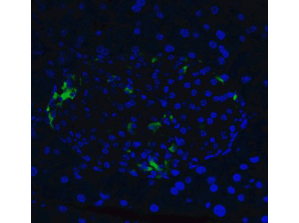 Immunofluorescence of XBP-1