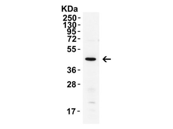 Western Blot of XBP-1