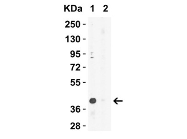 Western Blot of XBP-1