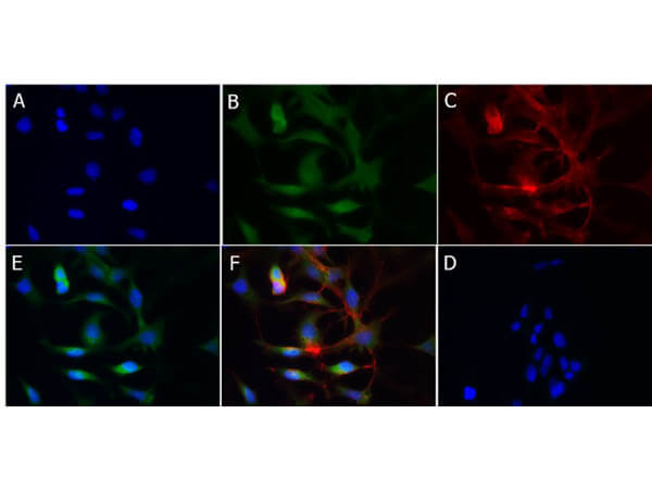 Immunofluorescence of Rabbit Anti-Cytochrome p450 Antibody