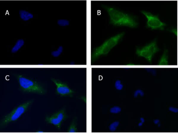 Immunofluorescence of Rabbit Anti-SQSTM1/p62 Antibody