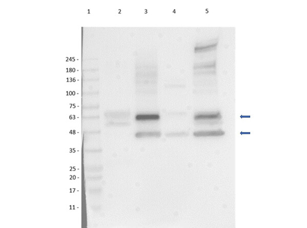Western Blot of Rabbit Anti-SQSTM1/p62 Antibody