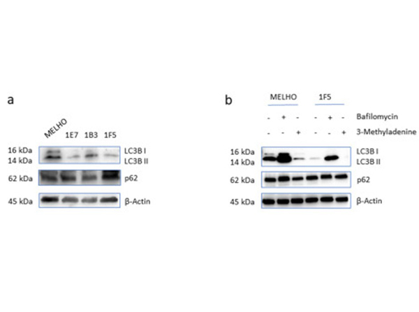Western Blot using SQSTM1