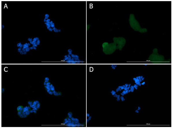 Immunofluorescence of Rabbit Anti-Ire1 Antibody