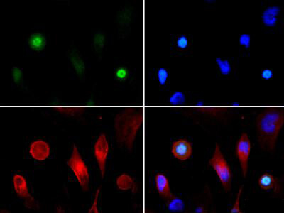 Histone H3 [p Thr3, ac Lys4] Immunofluorescence