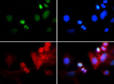 Histone H3 [Trimethyl Lys4, p Thr6] Immunofluorescence