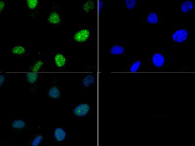 Histone H3 [p Thr6] Immunofluorescence
